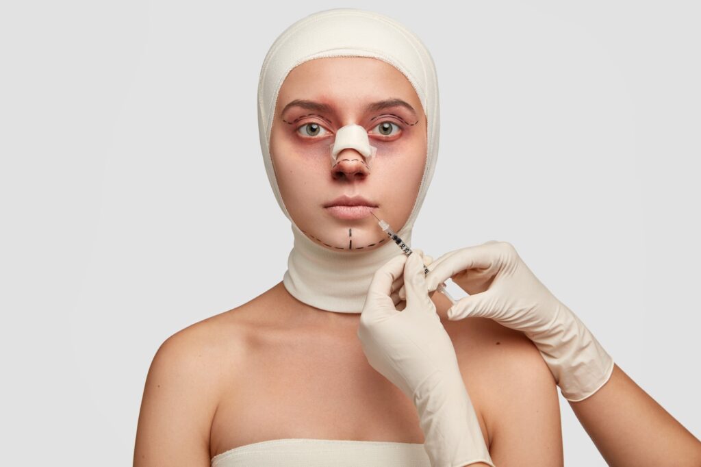 Can a Nose Job Be Covered by Insurance